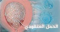 سلامة المرضى يركز على الرعاية المنزلية