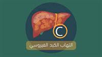  التهاب الكبد الفيروسي C