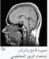 تصوير بالرنين المغناطيسي