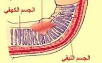 مرض بيروني