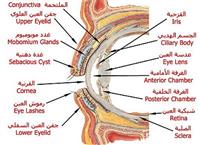 زرع القرنية وكيف تتم العملية